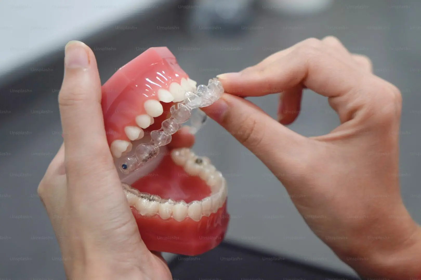 Hands holding dental model with aligner.